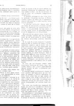 giornale/PUV0041812/1924/unico/00000065