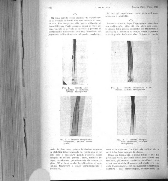 Il policlinico. Sezione pratica periodico di medicina, chirurgia e igiene