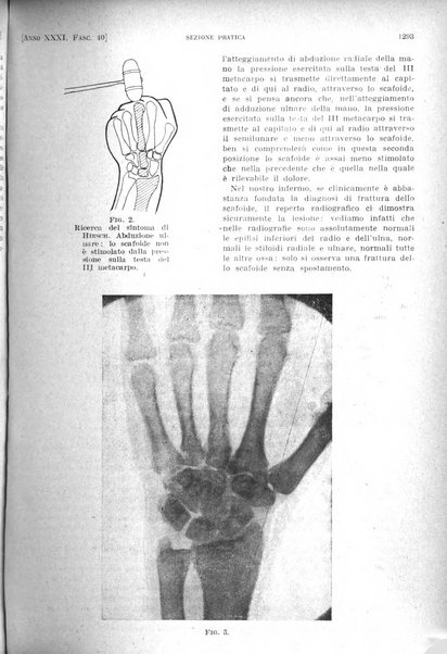 Il policlinico. Sezione pratica periodico di medicina, chirurgia e igiene