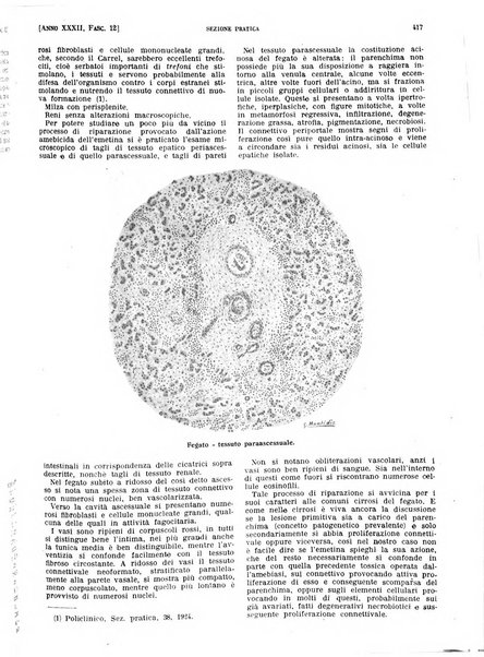 Il policlinico. Sezione pratica periodico di medicina, chirurgia e igiene