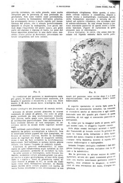 Il policlinico. Sezione pratica periodico di medicina, chirurgia e igiene