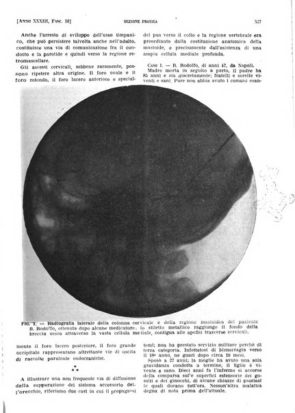 Il policlinico. Sezione pratica periodico di medicina, chirurgia e igiene