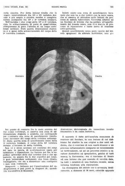 Il policlinico. Sezione pratica periodico di medicina, chirurgia e igiene