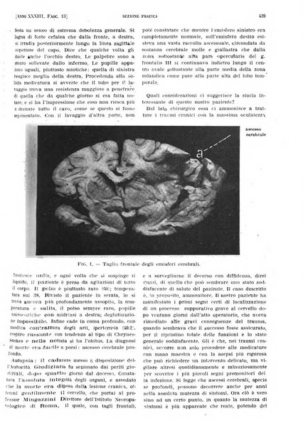 Il policlinico. Sezione pratica periodico di medicina, chirurgia e igiene