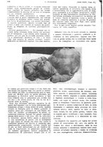 giornale/PUV0041812/1928/V.2/00000284
