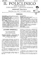 giornale/PUV0041812/1928/V.2/00000311