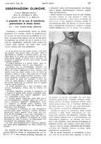 giornale/PUV0041812/1928/V.2/00000523