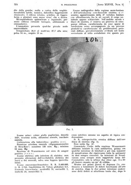 Il policlinico. Sezione pratica periodico di medicina, chirurgia e igiene