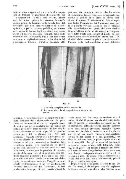 Il policlinico. Sezione pratica periodico di medicina, chirurgia e igiene