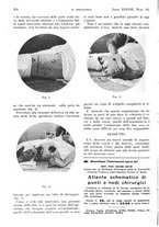 giornale/PUV0041812/1931/V.1/00000442