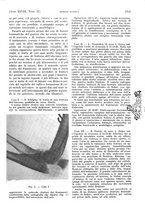 giornale/PUV0041812/1931/V.2/00000445