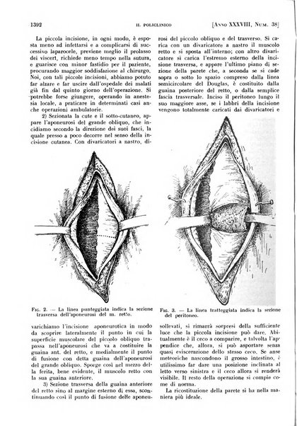 Il policlinico. Sezione pratica periodico di medicina, chirurgia e igiene