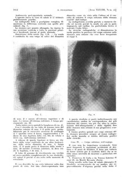 Il policlinico. Sezione pratica periodico di medicina, chirurgia e igiene