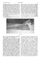 giornale/PUV0041812/1932/V.1/00000067