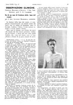giornale/PUV0041812/1932/V.1/00000103