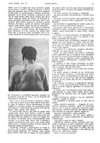 giornale/PUV0041812/1932/V.1/00000105