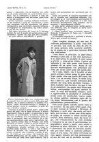 giornale/PUV0041812/1932/V.1/00000153