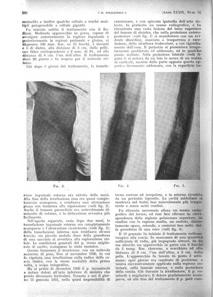 Il policlinico. Sezione pratica periodico di medicina, chirurgia e igiene