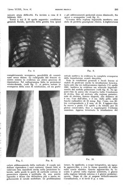 Il policlinico. Sezione pratica periodico di medicina, chirurgia e igiene