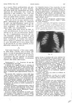 giornale/PUV0041812/1932/V.1/00000449