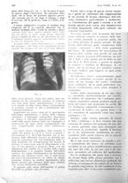 giornale/PUV0041812/1932/V.1/00000662