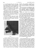 giornale/PUV0041812/1932/V.1/00001104