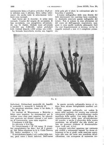 Il policlinico. Sezione pratica periodico di medicina, chirurgia e igiene