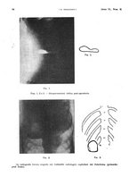 giornale/PUV0041812/1933/V.1/00000102