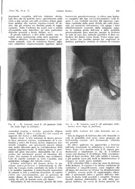 Il policlinico. Sezione pratica periodico di medicina, chirurgia e igiene