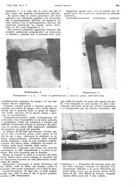 Il policlinico. Sezione pratica periodico di medicina, chirurgia e igiene