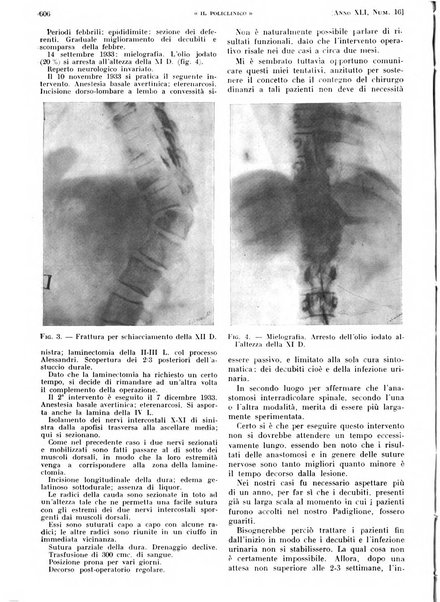 Il policlinico. Sezione pratica periodico di medicina, chirurgia e igiene