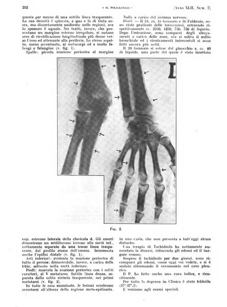 Il policlinico. Sezione pratica periodico di medicina, chirurgia e igiene