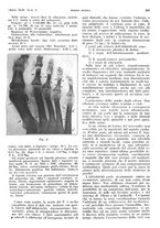 giornale/PUV0041812/1935/unico/00000301