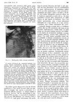 giornale/PUV0041812/1935/unico/00000871
