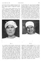 giornale/PUV0041812/1935/unico/00001023