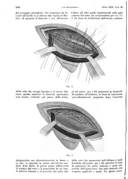 Il policlinico. Sezione pratica periodico di medicina, chirurgia e igiene