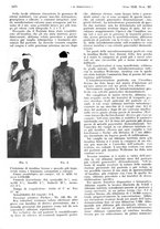 giornale/PUV0041812/1935/unico/00001128