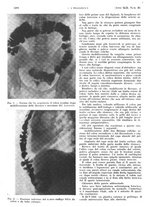 giornale/PUV0041812/1935/unico/00001338