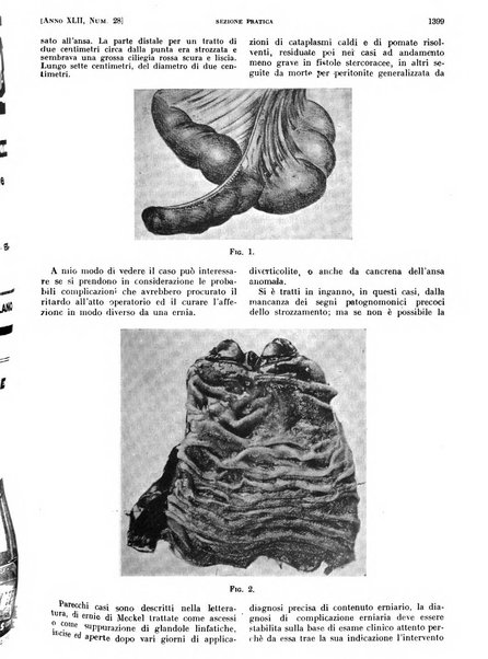 Il policlinico. Sezione pratica periodico di medicina, chirurgia e igiene