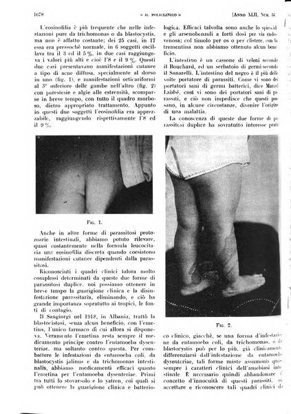 Il policlinico. Sezione pratica periodico di medicina, chirurgia e igiene