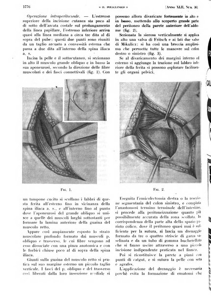 Il policlinico. Sezione pratica periodico di medicina, chirurgia e igiene