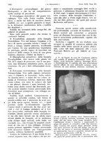 giornale/PUV0041812/1935/unico/00001874