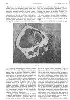 giornale/PUV0041812/1937/unico/00000354