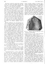 giornale/PUV0041812/1937/unico/00000608