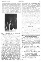 giornale/PUV0041812/1937/unico/00000609