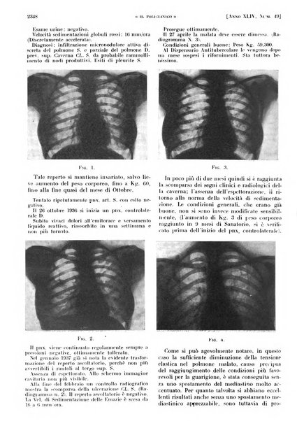 Il policlinico. Sezione pratica periodico di medicina, chirurgia e igiene