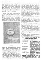 giornale/PUV0041812/1938/V.1/00000051