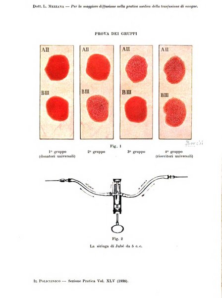 Il policlinico. Sezione pratica periodico di medicina, chirurgia e igiene