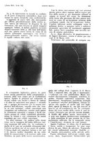 giornale/PUV0041812/1938/V.1/00000571