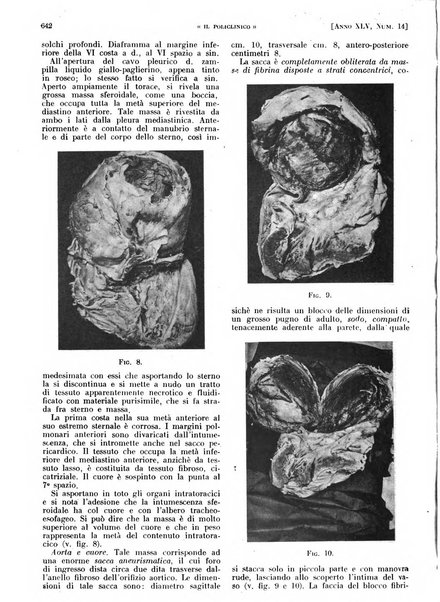 Il policlinico. Sezione pratica periodico di medicina, chirurgia e igiene